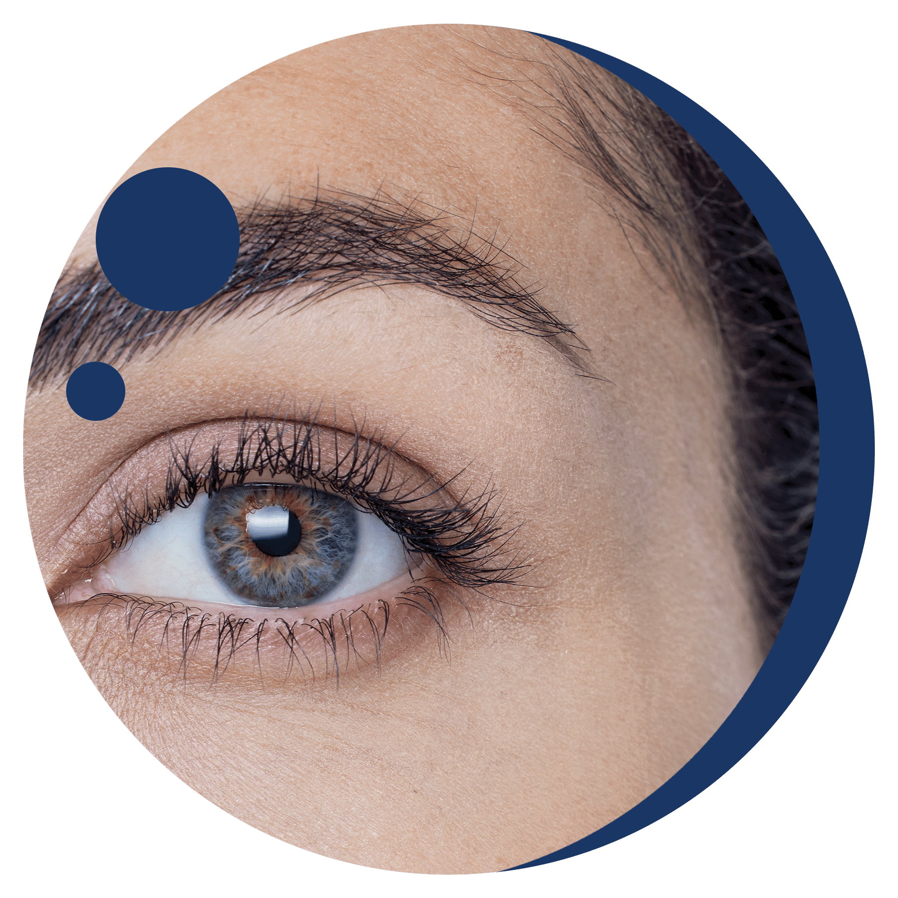disturbo della retinopatia diabetica